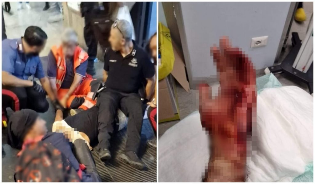 Choc ad Anagnina, armato di coccio di bottiglia aggredisce e ferisce guardia giurata