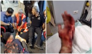 Choc ad Anagnina, armato di coccio di bottiglia aggredisce e ferisce guardia giurata