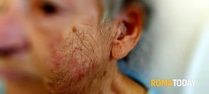 Anziana con il deambulatore aggredita in strada: "Colpita senza motivo"