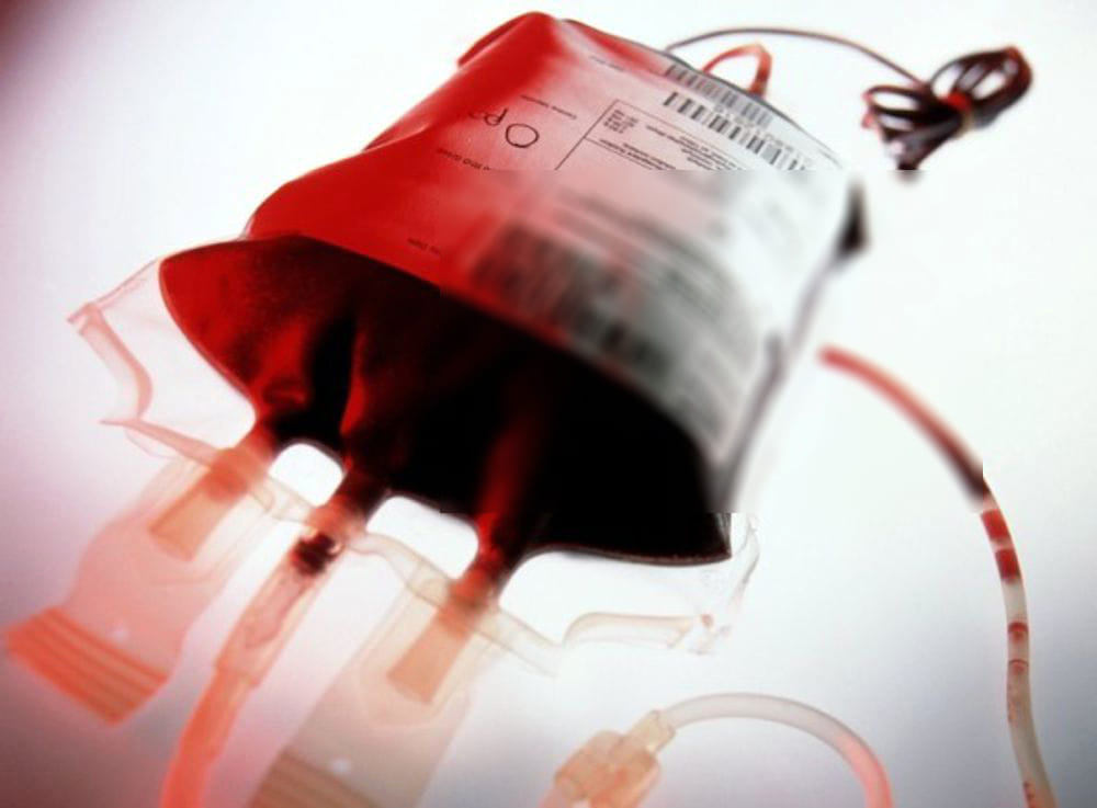 Muore per una trasfusione infetta. Risarcimento record per i familiari della vittima