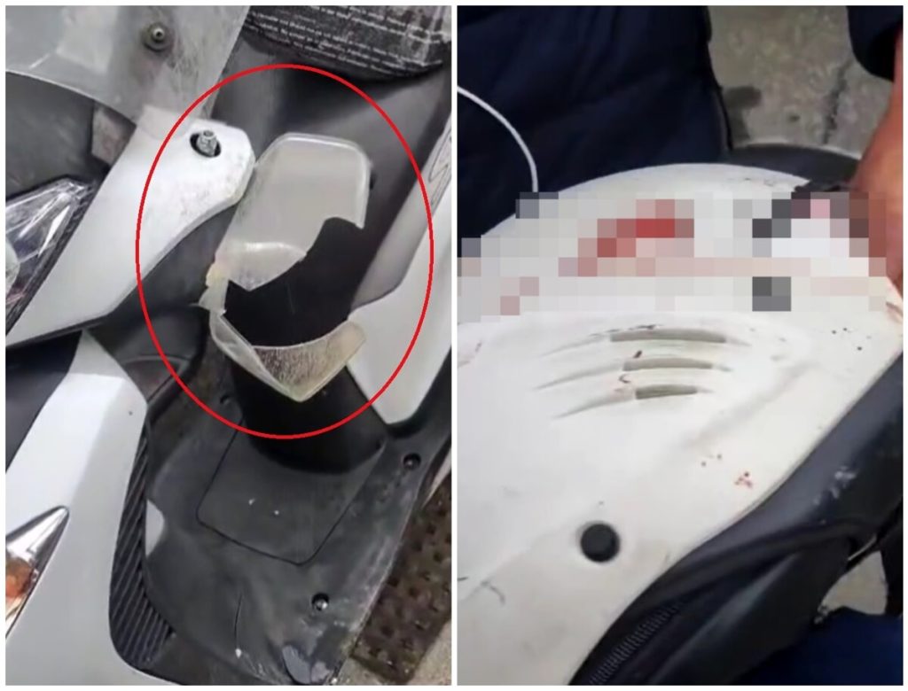 Incidente sull'Aurelia, perde controllo dello scooter: è in coma. La famiglia cerca testimoni