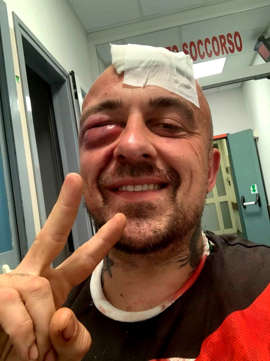 Chef Rubio massacrato di botte: "Sono stati i sionisti"