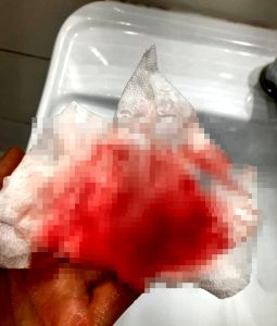 "Attenti, due corvi mi hanno ferito": paura a Roma sud