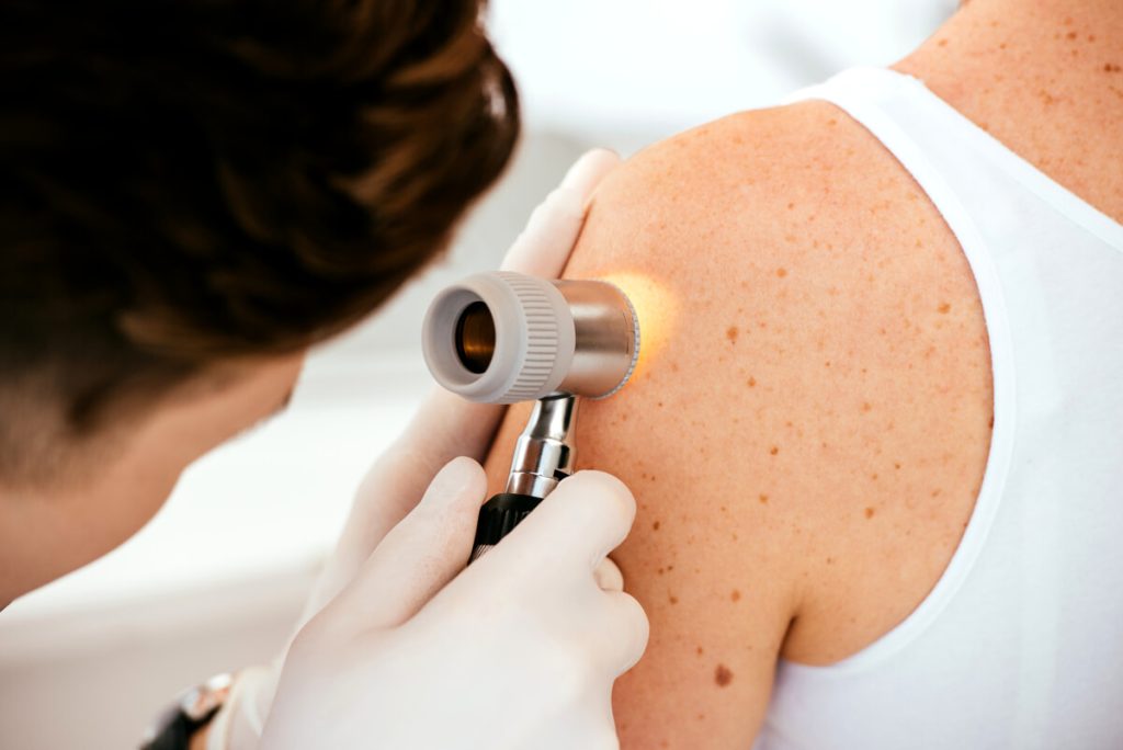 La malattia psoriasica: perché è importante riconoscere i sintomi