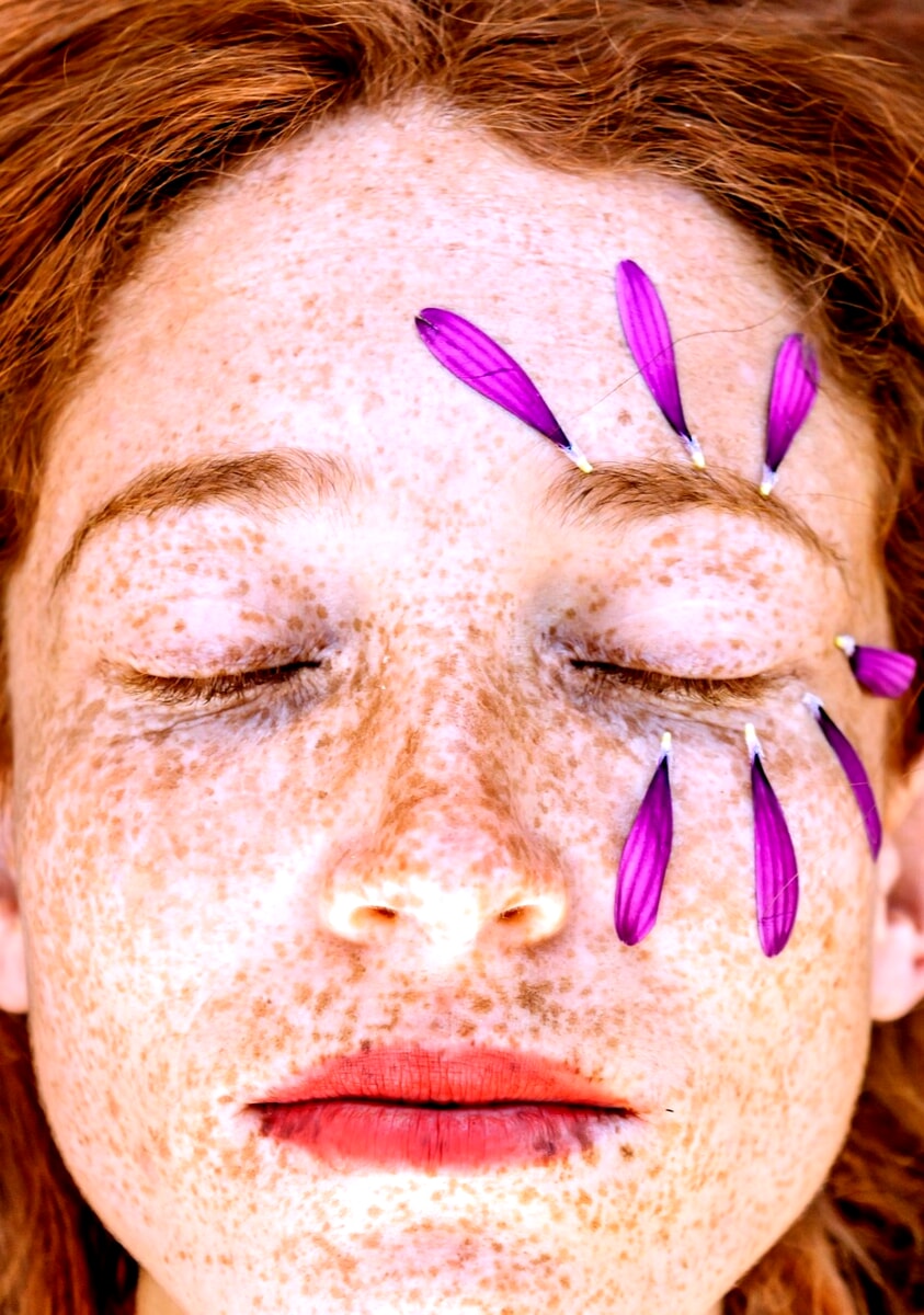 "Dopo le vacanze controllate le macchie della pelle": i consigli dei dermatologi