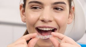 Patologie del cavo orale in bambini e ragazzi: un mese di prevenzione al Policlinico Gemelli