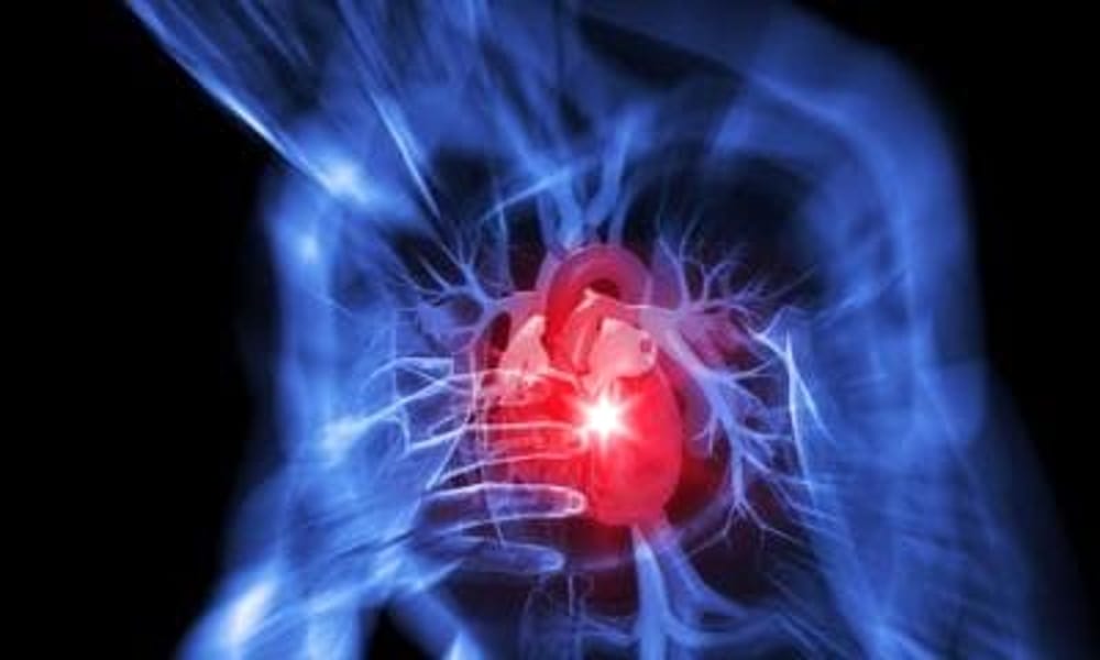 Nel Lazio 5mila infarti l'anno, uno studio mostra come intervenire subito per evitare le recidive