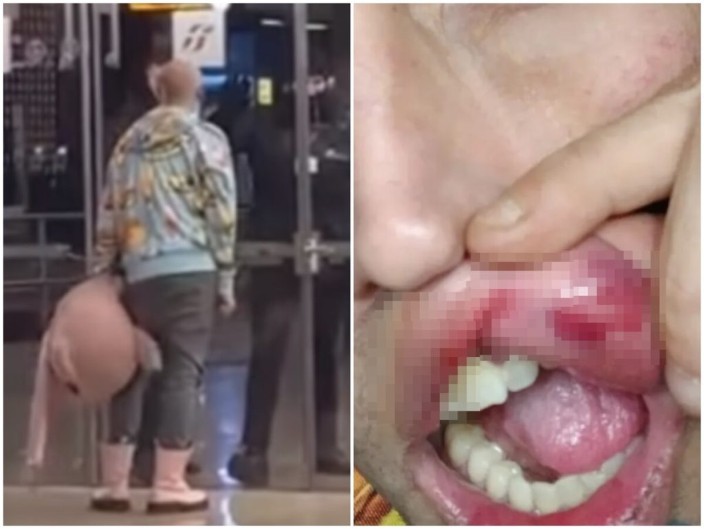 Performer picchiato e rapinato a Termini, il racconto choc: "Nessuno mi ha aiutato. Ora ho paura"