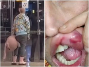Performer picchiato e rapinato a Termini, il racconto choc: "Nessuno mi ha aiutato. Ora ho paura"