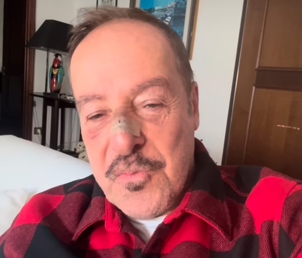 Massimo Lopez è stato investito da un pirata della strada
