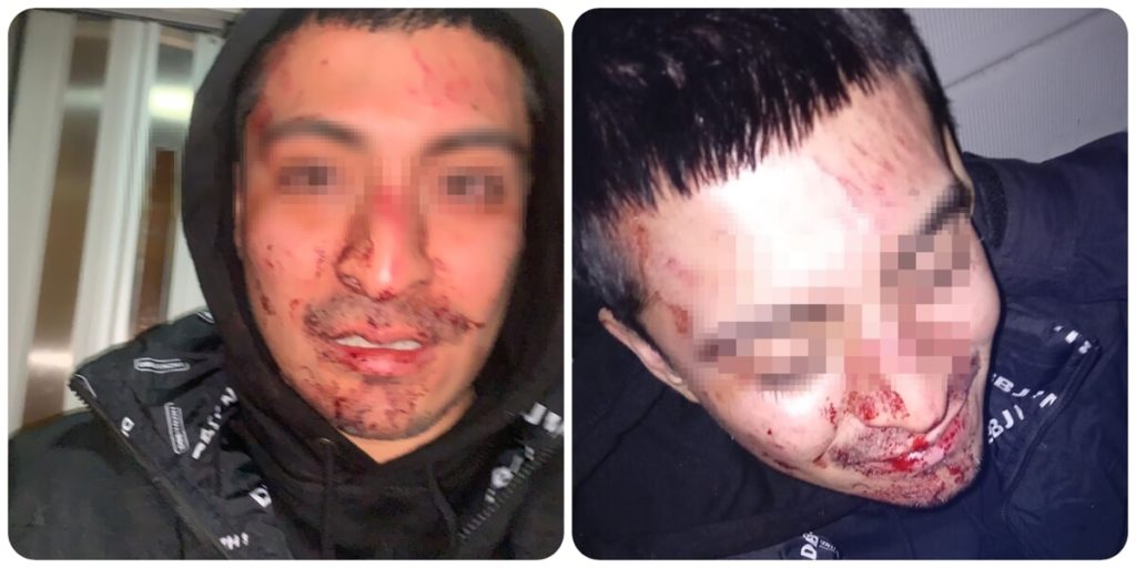 Coppia gay pestata a Capodanno, Roma si ribella all'omofobia: "Tolleranza zero"