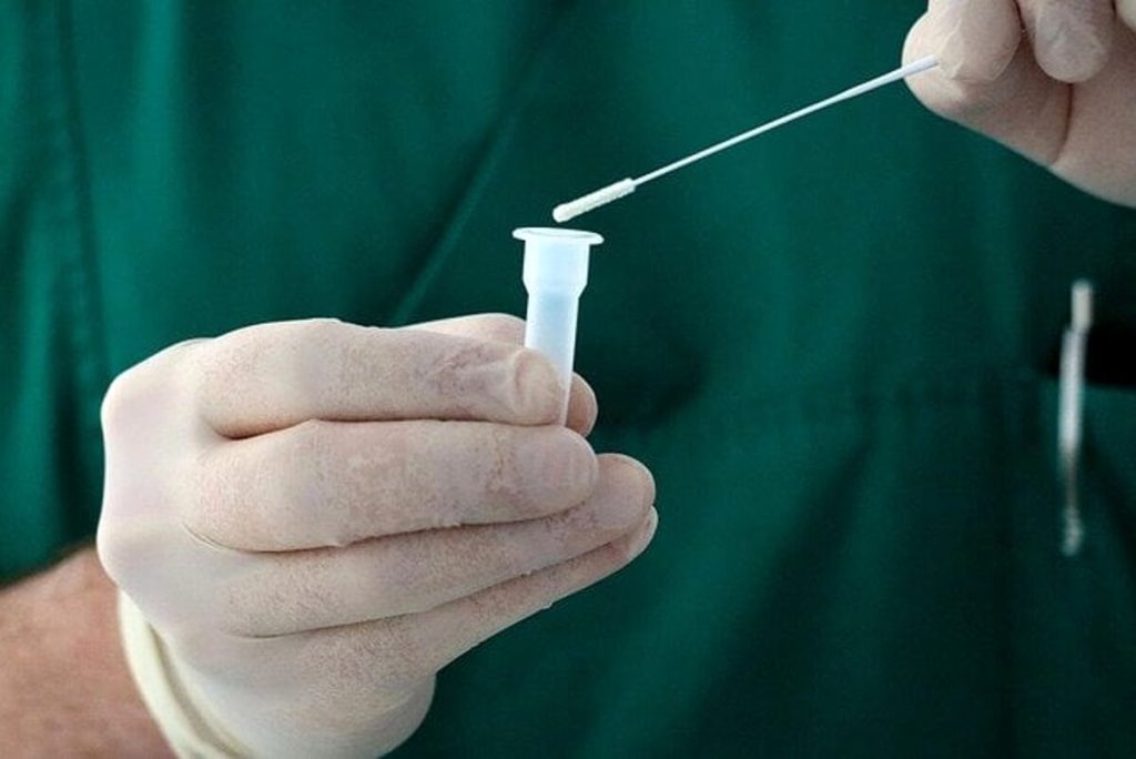 Long Covid, scoperta "l'impronta" molecolare nel sangue dei bimbi: lo studio del Bambino Gesù