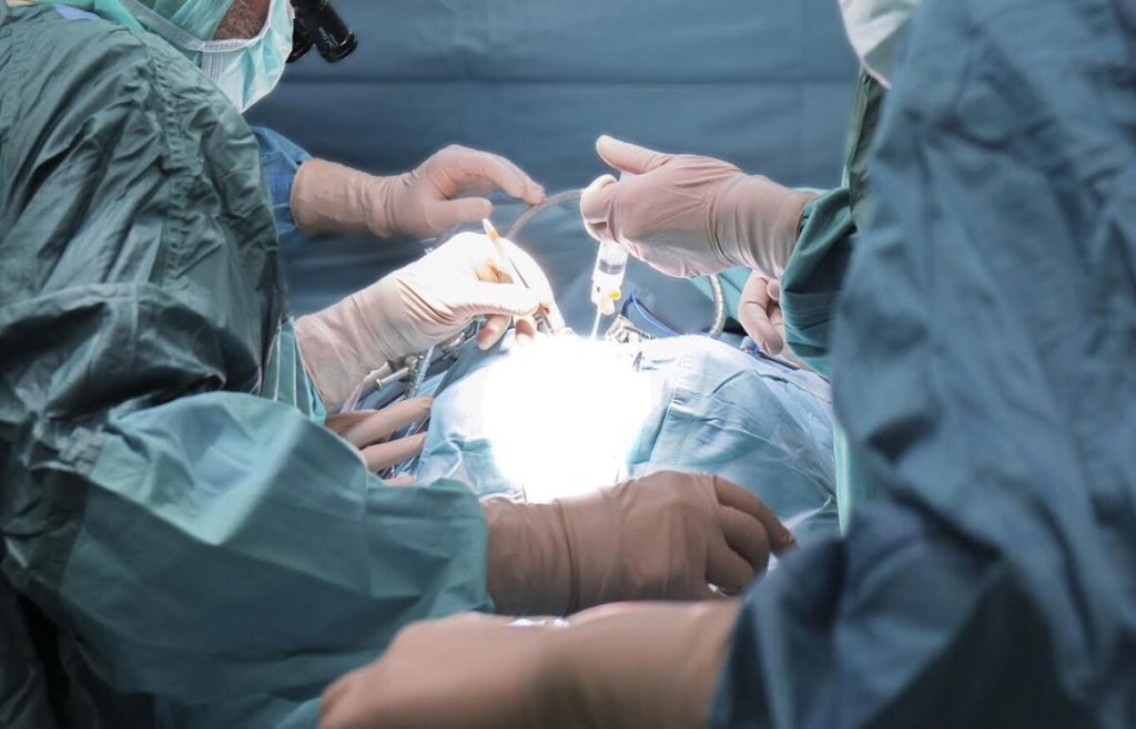 Rimosso dal corpo di una bambina di otto anni un tumore del rene grande fino al cuore