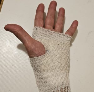 Anziana azzannata alla mano da un cane mentre passeggia in strada