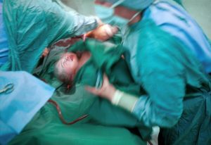 Epidurale negata. Il parto senza sofferenza non è per tutte